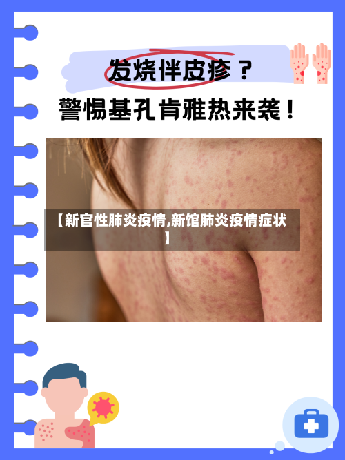 【新官性肺炎疫情,新馆肺炎疫情症状】-第3张图片