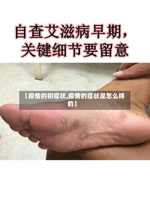 【疫情的初症状,疫情的症状是怎么样的】-第2张图片