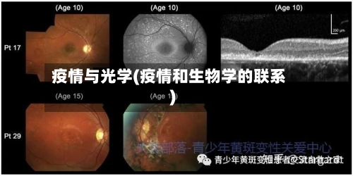 疫情与光学(疫情和生物学的联系)-第2张图片