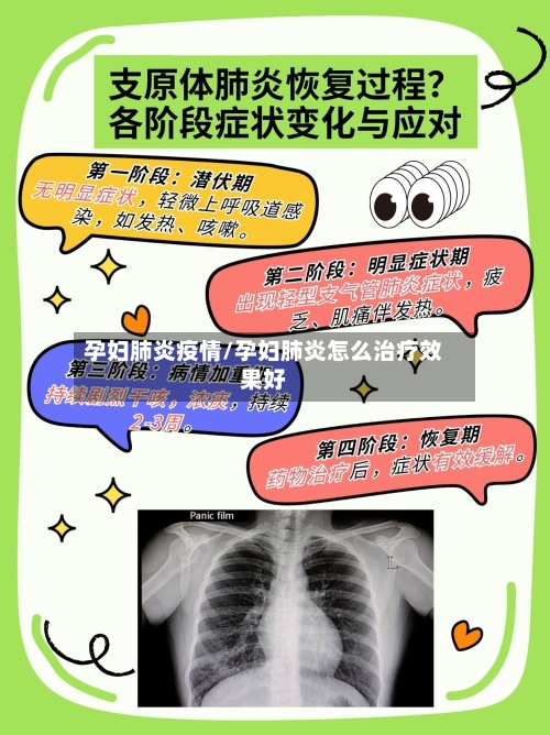 孕妇肺炎疫情/孕妇肺炎怎么治疗效果好-第2张图片