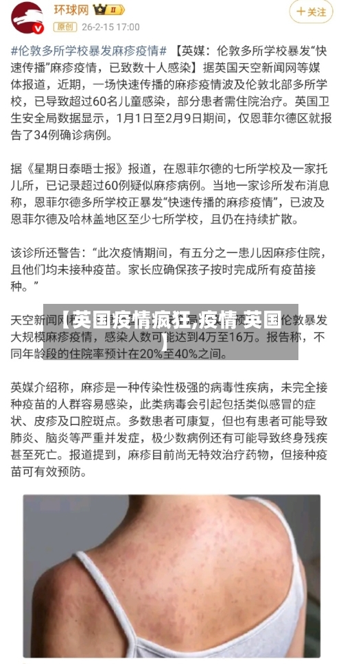 【英国疫情疯狂,疫情 英国】